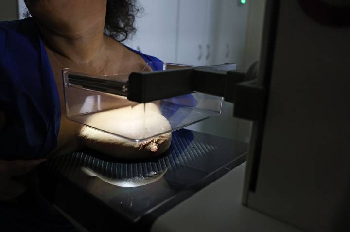 ANS defende que plano cubra mamografia digital sem restrição de idade